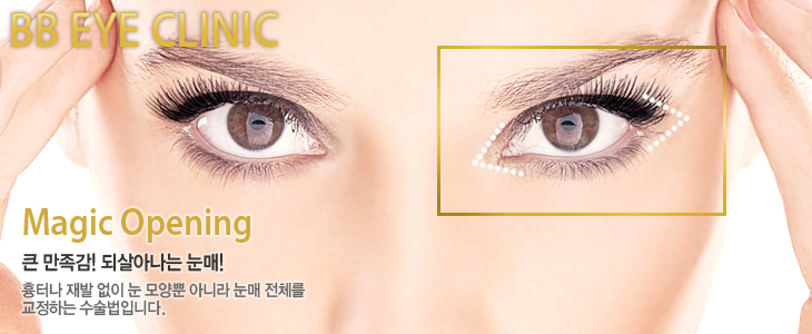 BB Eye Clinic Magic Opening 큰 만족감! 되살아나는 눈매! 흉터나 재발 없이 눈 모양뿐 아니라 눈매 전체를 교정하는 수술법입니다.